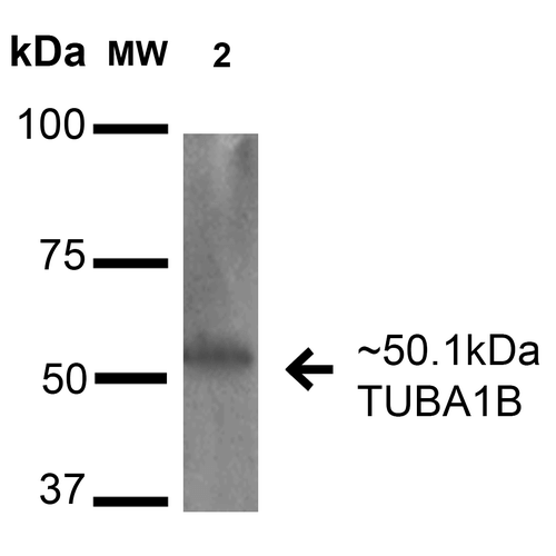TUBA1B / Tubulin Alpha 1B Antibody - Western blot analysis of Human Cervical cancer cell line (HeLa) lysate showing detection of 50.1 kDa alpha Tubulin Antibody protein using Rabbit Anti-alpha Tubulin Antibody Polyclonal Antibody. Lane 1: Molecular Weight Ladder (MW). Lane 2: Human HeLa cell lysates. Load: 15 µg. Block: 5% Skim Milk in 1X TBST. Primary Antibody: Rabbit Anti-alpha Tubulin Antibody Polyclonal Antibody  at 1:1000 for 16 hours at 4°C. Secondary Antibody: Goat-Anti-Rabbit IgG: HRP at 1:2000 for 60 min at RT. Color Development: TMB. Predicted/Observed Size: 50.1 kDa.