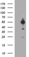 TUBA1B / Tubulin Alpha 1B Antibody - HEK293T cells were transfected with the pCMV6-ENTRY control (Left lane) or pCMV6-ENTRY TUBA1B (Right lane) cDNA for 48 hrs and lysed. Equivalent amounts of cell lysates (5 ug per lane) were separated by SDS-PAGE and immunoblotted with anti-TUBA1B.