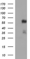 TUBA1B / Tubulin Alpha 1B Antibody - HEK293T cells were transfected with the pCMV6-ENTRY control (Left lane) or pCMV6-ENTRY TUBA1B (Right lane) cDNA for 48 hrs and lysed. Equivalent amounts of cell lysates (5 ug per lane) were separated by SDS-PAGE and immunoblotted with anti-TUBA1B.