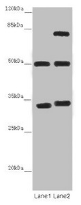 TUBA1B / Tubulin Alpha 1B Antibody - Western blot All Lanes: K-ALPHA-1 antibody at 12 ug/ml Lane 1: Mouse brain tissue Lane 2: Mouse liver tissue Secondary Goat polyclonal to rabbit IgG at 1/10000 dilution Predicted band size: 51,38 kDa Observed band size: 50,34,75 kDa