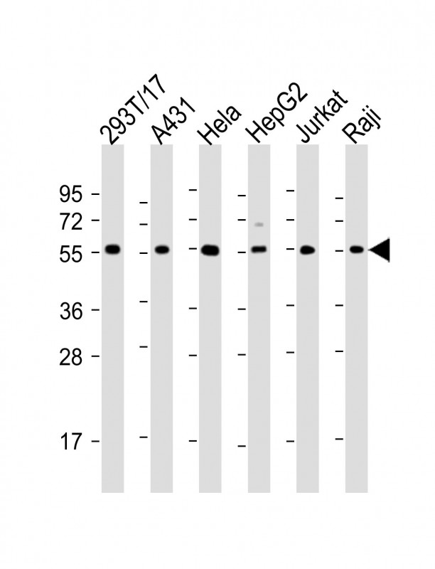 TUBA1B / Tubulin Alpha 1B Antibody - All lanes: Anti-alpha Tubulin Antibody at 1:2000 dilution Lane 1: 293T/17 whole cell lysate Lane 2: A431 whole cell lysate Lane 3: Hela whole cell lysate Lane 4: HepG2 whole cell lysate Lane 5: Jurkat whole cell lysate Lane 6: Raji whole cell lysate Lysates/proteins at 20 µg per lane. Secondary Goat Anti-Rabbit IgG, (H+L), Peroxidase conjugated at 1/10000 dilution. Predicted band size: 50 kDa Blocking/Dilution buffer: 5% NFDM/TBST.