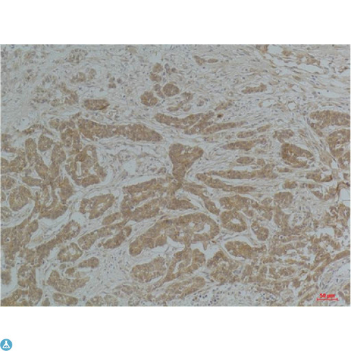 TUBA1B / Tubulin Alpha 1B Antibody - Immunohistochemistry (IHC) analysis of paraffin-embedded Human Brain Tissue using a-tubulin(Acetyl Lys40) Mouse monoclonal antibody diluted at 1:200.
