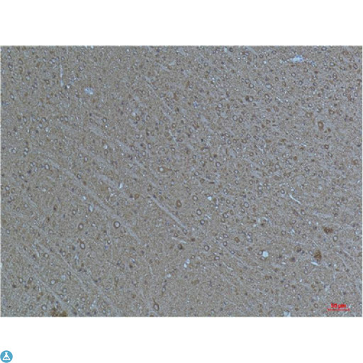 TUBA1B / Tubulin Alpha 1B Antibody - Immunohistochemical (IHC) analysis of paraffin-embedded Mouse Brain Tissue using a-tubulin(Acetyl Lys40) Mouse monoclonal antibody diluted at 1:200.