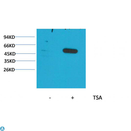 TUBA1B / Tubulin Alpha 1B Antibody - Western Blot (WB) analysis of extracts from HeLa cells, untreated (-) or treated with TSA (1muM, 18 hr+), using Acetyl- a-tubulin(Lys40) Mouse Monoclonal Antibody 1:2000.