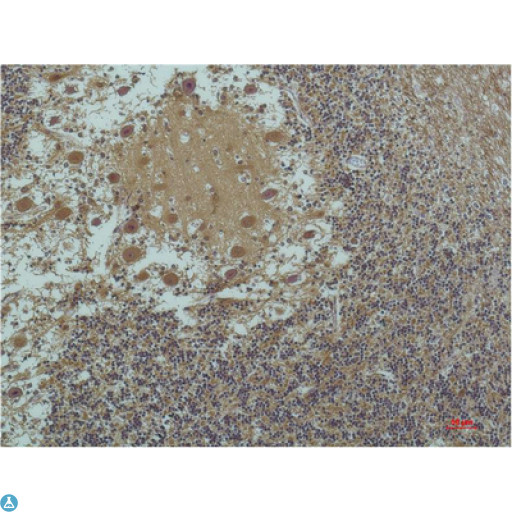 TUBA1B / Tubulin Alpha 1B Antibody - Immunohistochemical (IHC) analysis of paraffin-embedded Human Brain Tissue using a-tubulin(Acetyl Lys40) Mouse Monoclonal Antibody diluted at 1:200.