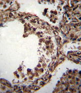 TUBA1C / Tubulin Alpha 1C Antibody - TUBA1C Antibody immunohistochemistry of formalin-fixed and paraffin-embedded human lung tissue followed by peroxidase-conjugated secondary antibody and DAB staining.