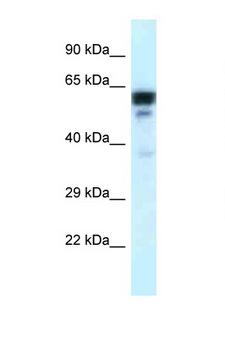 TUBA1C / Tubulin Alpha 1C Antibody - TUBA1C antibody Western blot of Placenta lysate. Antibody concentration 1 ug/ml.  This image was taken for the unconjugated form of this product. Other forms have not been tested.