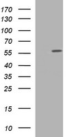 TUBA1C / Tubulin Alpha 1C Antibody - HEK293T cells were transfected with the pCMV6-ENTRY control (Left lane) or pCMV6-ENTRY TUBA1C (Right lane) cDNA for 48 hrs and lysed. Equivalent amounts of cell lysates (5 ug per lane) were separated by SDS-PAGE and immunoblotted with anti-TUBA1C.