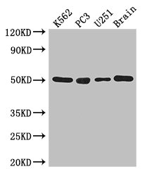 TUBA1C / Tubulin Alpha 1C Antibody - Western Blot Positive WB detected in:K562 whole cell lysate,PC3 whole cell lysate,U251 whole cell lysate,Mouse brain tissue All Lanes: TUBA1C antibody at 3ug/ml Secondary Goat polyclonal to rabbit IgG at 1/50000 dilution Predicted band size: 50 kDa Observed band size: 50 kDa