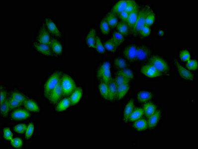 TUBA3C / Tubulin Alpha 3C Antibody - Immunofluorescent analysis of HepG2 cells using TUBA3C Antibody at dilution of 1:100 and Alexa Fluor 488-congugated AffiniPure Goat Anti-Rabbit IgG(H+L)