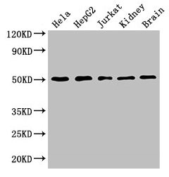 TUBA3C / Tubulin Alpha 3C Antibody - Western Blot Positive WB detected in: Hela whole cell lysate, NIH/3T3 whole cell lysate, HepG2 whole cell lysate, Jurkat whole cell lysate, Mouse kidney tissue, Mouse brain tissue All lanes: TUBA3C antibody at 3µg/ml Secondary Goat polyclonal to rabbit IgG at 1/50000 dilution Predicted band size: 50, 47 kDa Observed band size: 50, 34 kDa