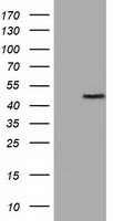 TUBA3E / Tubulin Alpha 3E Antibody - HEK293T cells were transfected with the pCMV6-ENTRY control (Left lane) or pCMV6-ENTRY TUBA3E (Right lane) cDNA for 48 hrs and lysed. Equivalent amounts of cell lysates (5 ug per lane) were separated by SDS-PAGE and immunoblotted with anti-TUBA3E.