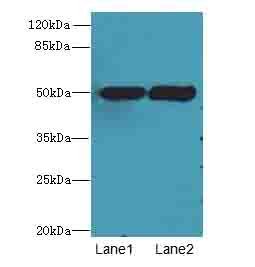 TUBA3E / Tubulin Alpha 3E Antibody - Western blot. All lanes: TUBA3E antibody at 3 ug/ml. Lane 1: MCF7 whole cell lysate. Lane 2: HeLa whole cell lysate. Secondary Goat polyclonal to Rabbit IgG at 1:10000 dilution. Predicted band size: 50 kDa. Observed band size: 50 kDa.