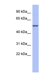 TUBA4A / TUBA1 Antibody - TUBA4A antibody Western blot of Fetal Small Intestine lysate. This image was taken for the unconjugated form of this product. Other forms have not been tested.