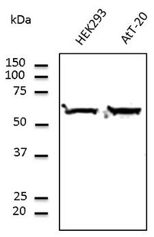 TUBA4A / TUBA1 Antibody - Western blot. Anti-Tubulin alpha4A antibody at 1:1000 dilution. Lysates at 100 ug per lane. Rabbit polyclonal to goat IgG (HRP) at 1:10000 dilution.