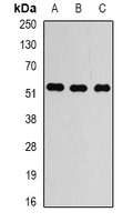 TUBA4A / TUBA1 Antibody - Western blot analysis of Alpha-tubulin 4a expression in LOVO (A); HEK293T (B); HUVEC (C) whole cell lysates.