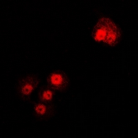 TUBA4A / TUBA1 Antibody - Immunofluorescent analysis of Alpha-tubulin 4a staining in U2OS cells. Formalin-fixed cells were permeabilized with 0.1% Triton X-100 in TBS for 5-10 minutes and blocked with 3% BSA-PBS for 30 minutes at room temperature. Cells were probed with the primary antibody in 3% BSA-PBS and incubated overnight at 4 deg C in a humidified chamber. Cells were washed with PBST and incubated with a DyLight 594-conjugated secondary antibody (red) in PBS at room temperature in the dark.