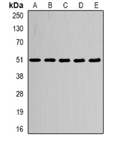TUBA4A / TUBA1 Antibody - Western blot analysis of Alpha-tubulin 4a expression in HepG2 (A); MCF7 (B); mouse heart (C); mouse brain (D); PC12 (E) whole cell lysates.