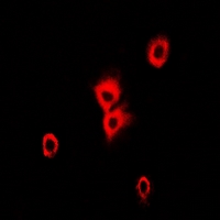 TUBA4A / TUBA1 Antibody - Immunofluorescent analysis of Alpha-tubulin 4a staining in HeLa cells. Formalin-fixed cells were permeabilized with 0.1% Triton X-100 in TBS for 5-10 minutes and blocked with 3% BSA-PBS for 30 minutes at room temperature. Cells were probed with the primary antibody in 3% BSA-PBS and incubated overnight at 4 deg C in a humidified chamber. Cells were washed with PBST and incubated with a DyLight 594-conjugated secondary antibody (red) in PBS at room temperature in the dark.