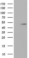 TUBA8 / Tubulin Alpha 8 Antibody - HEK293T cells were transfected with the pCMV6-ENTRY control (Left lane) or pCMV6-ENTRY TUBA8 (Right lane) cDNA for 48 hrs and lysed. Equivalent amounts of cell lysates (5 ug per lane) were separated by SDS-PAGE and immunoblotted with anti-TUBA8.
