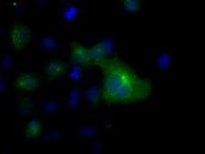 TUBA8 / Tubulin Alpha 8 Antibody - IHC of paraffin-embedded colon tissue using anti- mouse monoclonal antibody. (Dilution 1:50).