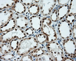 TUBA8 / Tubulin Alpha 8 Antibody - IHC of paraffin-embedded Kidney tissue using anti- mouse monoclonal antibody. (Dilution 1:50).