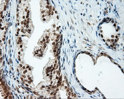 TUBA8 / Tubulin Alpha 8 Antibody - IHC of paraffin-embedded prostate tissue using anti- mouse monoclonal antibody. (Dilution 1:50).