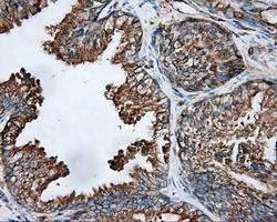 TUBA8 / Tubulin Alpha 8 Antibody - Immunohistochemical staining of paraffin-embedded prostate tissue using anti-TUBA8 mouse monoclonal antibody. (Dilution 1:50).
