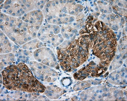 TUBA8 / Tubulin Alpha 8 Antibody - Immunohistochemical staining of paraffin-embedded pancreas tissue using anti-TUBA8 mouse monoclonal antibody. (Dilution 1:50).