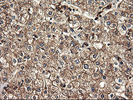 TUBAL3 Antibody - IHC of paraffin-embedded Human liver tissue using anti-TUBAL3 mouse monoclonal antibody.