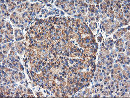TUBAL3 Antibody - IHC of paraffin-embedded Human pancreas tissue using anti-TUBAL3 mouse monoclonal antibody.