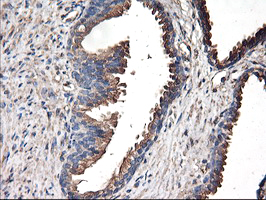TUBAL3 Antibody - IHC of paraffin-embedded Human prostate tissue using anti-TUBAL3 mouse monoclonal antibody.