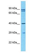 TUBAL3 Antibody - TUBAL3 antibody Western Blot of HT1080. Antibody dilution: 1 ug/ml.  This image was taken for the unconjugated form of this product. Other forms have not been tested.