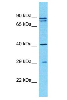 TUBAL3 Antibody - TUBAL3 antibody Western Blot of HT1080. Antibody dilution: 1 ug/ml.  This image was taken for the unconjugated form of this product. Other forms have not been tested.