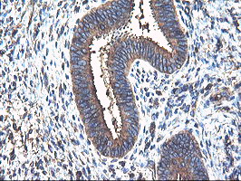 TUBAL3 Antibody - IHC of paraffin-embedded Human endometrium tissue using anti-TUBAL3 mouse monoclonal antibody.