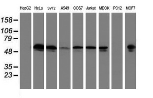 TUBAL3 Antibody - Western blot of extracts (35 ug) from 9 different cell lines by using anti-TUBAL3 monoclonal antibody (HepG2: human; HeLa: human; SVT2: mouse; A549: human; COS7: monkey; Jurkat: human; MDCK: canine; PC12: rat; MCF7: human).