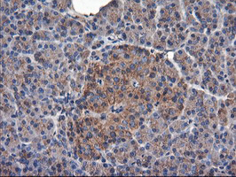 TUBAL3 Antibody - IHC of paraffin-embedded Human pancreas tissue using anti-TUBAL3 mouse monoclonal antibody.
