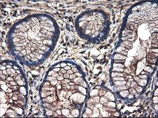 TUBAL3 Antibody - IHC of paraffin-embedded Human colon tissue using anti-TUBAL3 mouse monoclonal antibody.