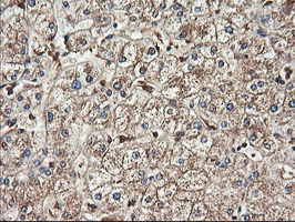 TUBAL3 Antibody - IHC of paraffin-embedded Human liver tissue using anti-TUBAL3 mouse monoclonal antibody.