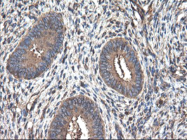 TUBAL3 Antibody - IHC of paraffin-embedded Human endometrium tissue using anti-TUBAL3 mouse monoclonal antibody.