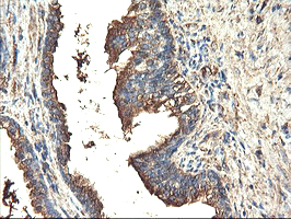 TUBAL3 Antibody - IHC of paraffin-embedded Human prostate tissue using anti-TUBAL3 mouse monoclonal antibody.