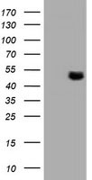 TUBAL3 Antibody - HEK293T cells were transfected with the pCMV6-ENTRY control (Left lane) or pCMV6-ENTRY TUBAL3 (Right lane) cDNA for 48 hrs and lysed. Equivalent amounts of cell lysates (5 ug per lane) were separated by SDS-PAGE and immunoblotted with anti-TUBAL3.