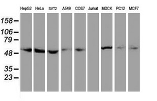 TUBAL3 Antibody - Western blot of extracts (35 ug) from 9 different cell lines by using anti-TUBAL3 monoclonal antibody.