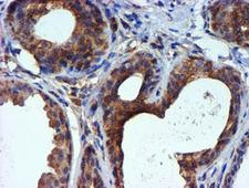TUBAL3 Antibody - IHC of paraffin-embedded Human breast tissue using anti-TUBAL3 mouse monoclonal antibody.