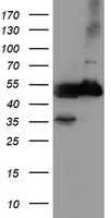 TUBAL3 Antibody - HEK293T cells were transfected with the pCMV6-ENTRY control (Left lane) or pCMV6-ENTRY TUBAL3 (Right lane) cDNA for 48 hrs and lysed. Equivalent amounts of cell lysates (5 ug per lane) were separated by SDS-PAGE and immunoblotted with anti-TUBAL3.