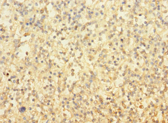 TUBAL3 Antibody - Immunohistochemistry of paraffin-embedded human spleen tissue using TUBAL3 Antibody at dilution of 1:100