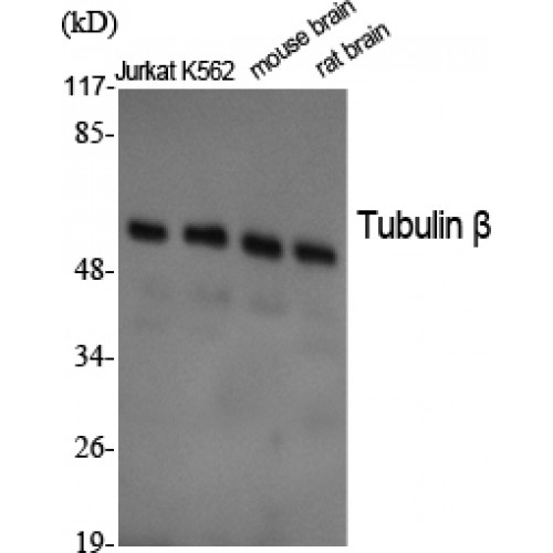 TUBB / Beta Tubulin Antibody - Western blot of Tubulin beta antibody