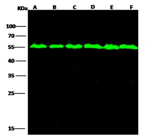 TUBB / Beta Tubulin Antibody - Anti-Beta-Tubulin mouse monoclonal antibody at 1:2000 dilution. Lane A: HepG2 Whole Cell Lysate. Lane B: Daudi Whole Cell Lysate. Lane C: MOLT-4 Whole Cell Lysate. Lane D: A549 Whole Cell Lysate. Lane E: 293T Whole Cell Lysate. Lane F: HelaS3 Whole Cell Lysate. Lysates/proteins at 30 ug per lane. Secondary: Goat Anti-Mouse IgG H&L (Dylight800) at 1/15000 dilution. Developed using the Odyssey technique. Performed under reducing conditions. Predicted band size: 50 kDa. Observed band size: 54 kDa.