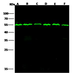 TUBB / Beta Tubulin Antibody - Anti-Beta-Tubulin mouse monoclonal antibody at 1:2000 dilution. Lane A: Jurkat Whole Cell Lysate. Lane B: 293T Whole Cell Lysate. Lane C: K562 Whole Cell Lysate. Lane D: Hela Whole Cell Lysate. Lane E: RAW264.7 Whole Cell Lysate. Lysates/proteins at 30 ug per lane. Secondary: Goat Anti-Mouse IgG H&L (Dylight800) at 1/15000 dilution. Developed using the Odyssey technique. Performed under reducing conditions. Predicted band size: 50 kDa. Observed band size: 54 kDa.