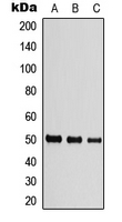 TUBB / Beta Tubulin Antibody - Western blot analysis of Beta-tubulin expression in HEK293T (A); Raw264.7 (B); PC12 (C) whole cell lysates.